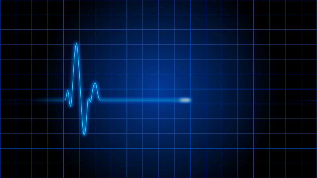 ekg-001-an-electrocardiogram-heart-monitor-pulses-on-a-blue-grid-loop_r4m_frdh_thumbnail-full01